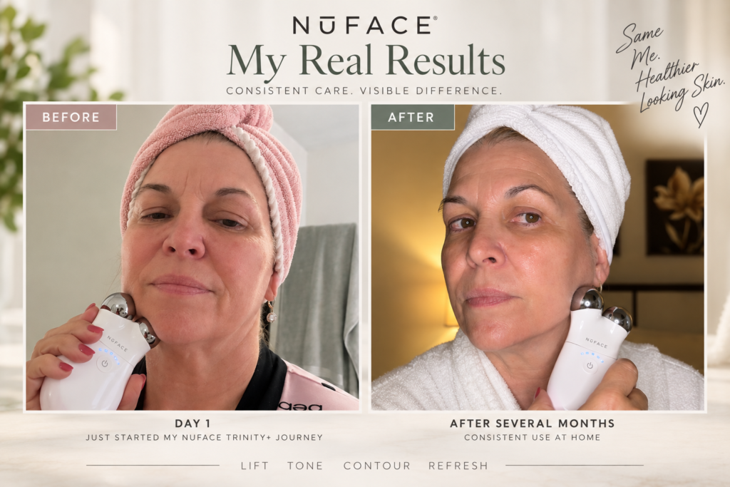 NuFACE Trinity results before and after several months of consistent use